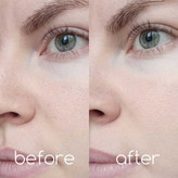 فوم شستشوی عمیق کنترل منافذ سنتلا Centella اسکین 1004 Skin مدل Madagascar Poremizing حجم 125ml